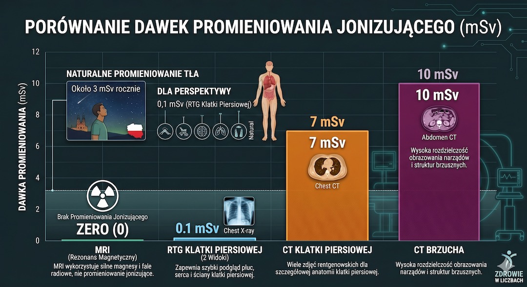 Infografika por&oacute;wnująca dawki promieniowania RTG CT i MRI w milisiwertach z odniesieniem do naturalnego tła radiacyjnego
